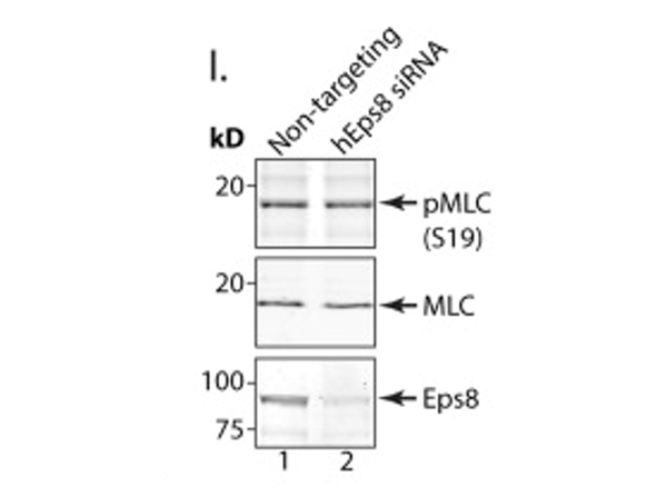 Western Blot using Myosin pS19pS20